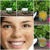 Taruvar Ayurveda - For Pigmentation and Uneven skin tone(for Oily or Combination skin) - Taruvar Ayurveda