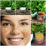 Taruvar Ayurveda - For Pigmentation and Uneven skin tone (For Dry skin) - Taruvar Ayurveda